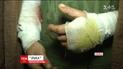 Раненых бойцов со Светлодарской дуги доставили в Винницкий военный госпиталь