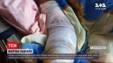 Новости Украины: суд изберет меру пресечения для 17-летнего юноши, поджегшего беременную женщину