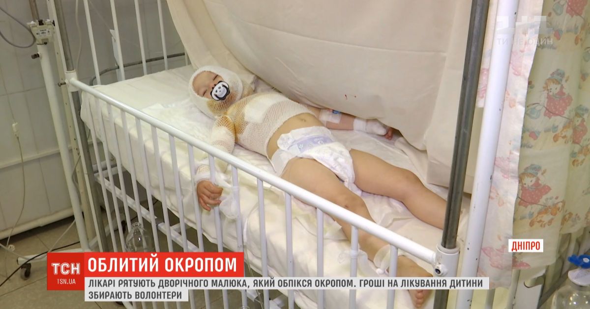 В реанимации в днепре спасают двухлетнего малыша, который обжегся кипятком