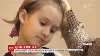 Следователи в течение 2,5 лет не могут найти виновных в травмировании девочки в детском саду Кременчуга