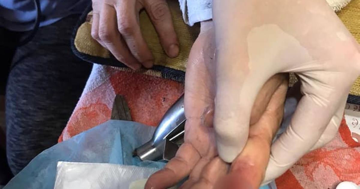 У Києві жінка засунула пальці до насадки ручного блендера