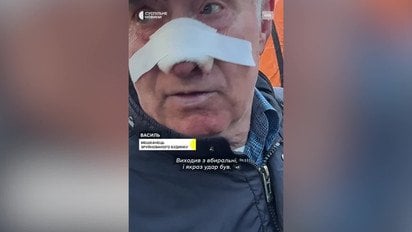 "Відкинуло хвилею та розбило носа": розповідь киянина про пекельну ніч у столиці