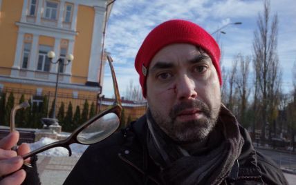 На "трансмарші" у Києві радикали побили іноземного журналіста