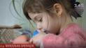 Київські хірурги провели унікальну серію операцій для шестирічної дівчинки з вродженими вадами
