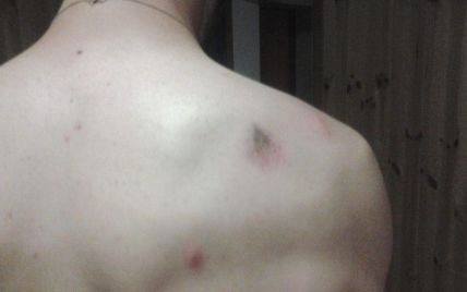 В Киеве охранник избил парня из-за желания покупаться