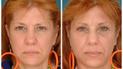 Джанет і Джин / Фото: Dr. Bahman Guyuron / American Society of Plastic Surgeons