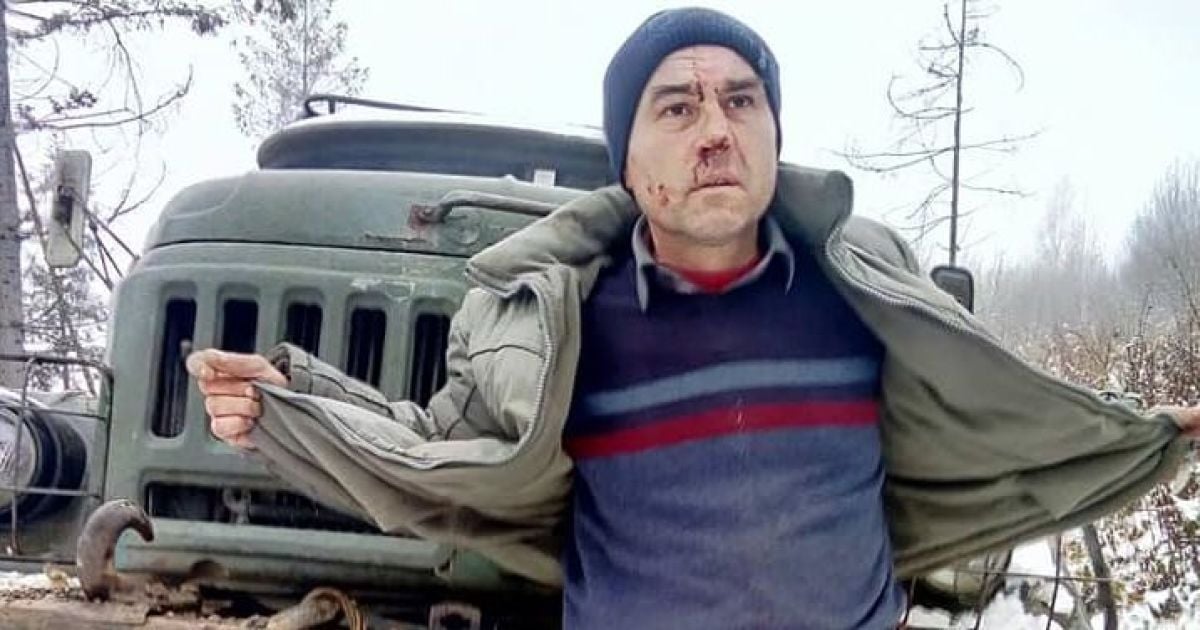 Побиття журналіста на Сколівщині_5