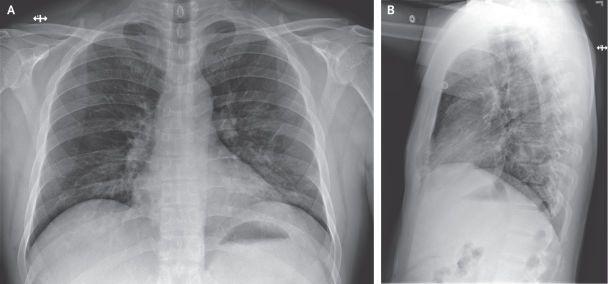  / © The New England Journal of Medicine