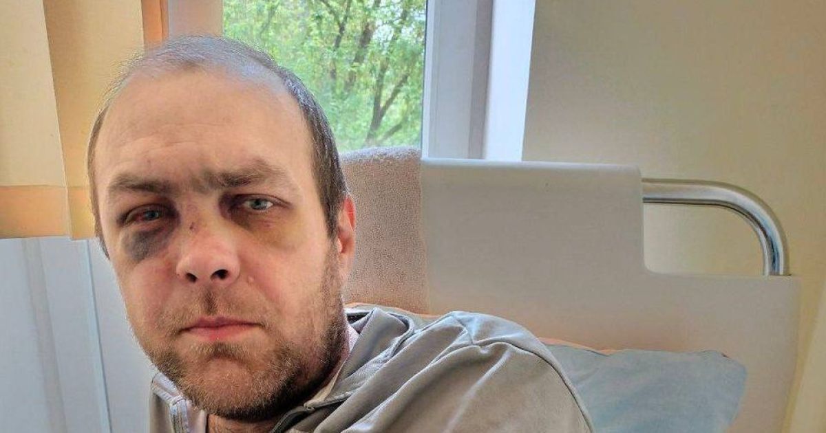 Орест Паньків після побиття чоловіком у військовій формі