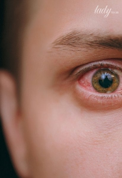 Очі чоловіка