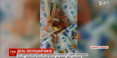 Самый крохотный малыш в Украине родился в Днепре