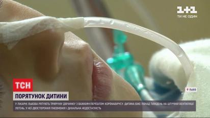 Друга в країні: у Львові хвору на коронавірус дитину під'єднали до ШВЛ