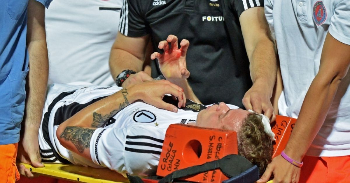 Дуда покинул поле на носилках.