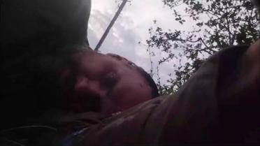 Сенцов получил контузию во время ближнего боя на фронте