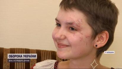 Школьники собранные на свой выпускной деньги отдали травмированной ракетным ударом девушке