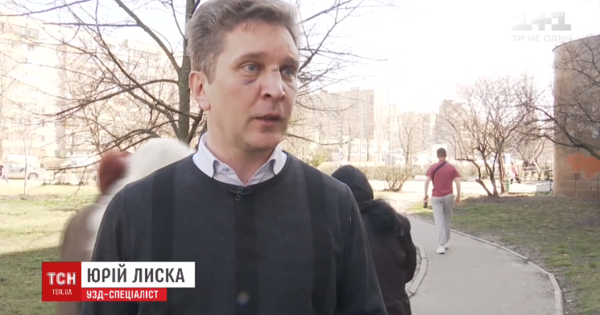 В Киеве жестоко избили врача, который рассказал о коррупции в медучреждении
