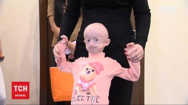 Украинские врачи сделали уникальную операцию девочке, у которой зубы начали расти в два ряда