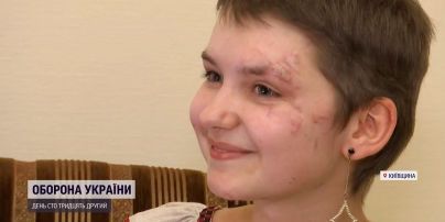 Школярі зібрані на свій випускний гроші віддали травмованій ракетним ударом дівчині