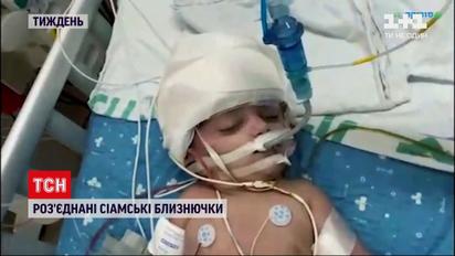 Сіамські близнючки, політ на астероїд і Шнобелівська премія – новини з онлайн-трансляції