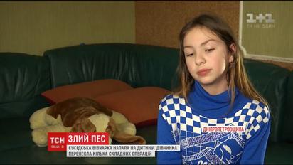 Пес, который жестоко покусал 7-летнюю девочку, два года остается безнаказанным
