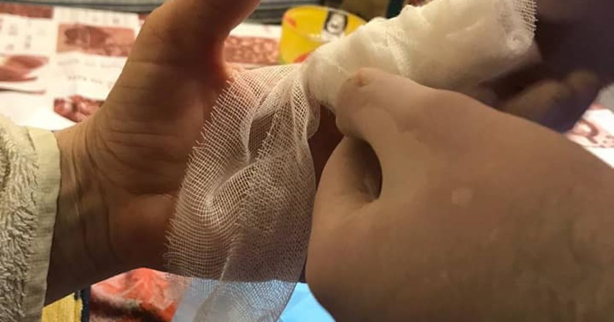 У Києві жінка засунула пальці до насадки ручного блендера