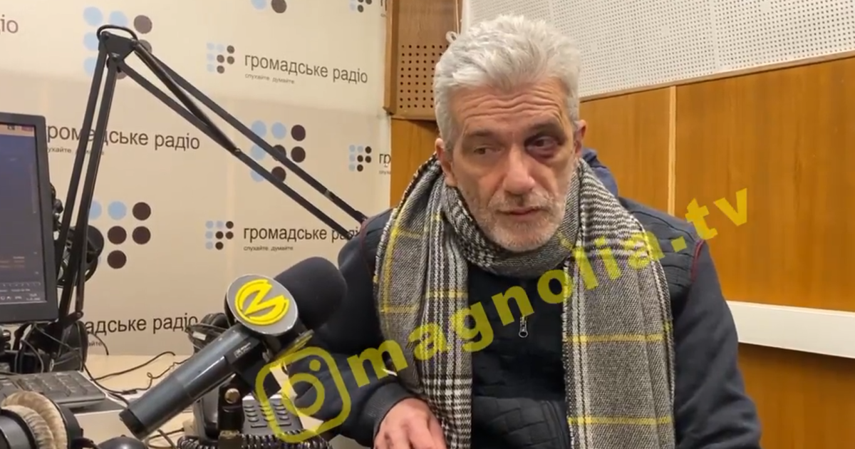 "90-ті повертаються - це гоп-стоп": журналіст Куликов дав перше інтерв'ю після нападу з пограбуванням