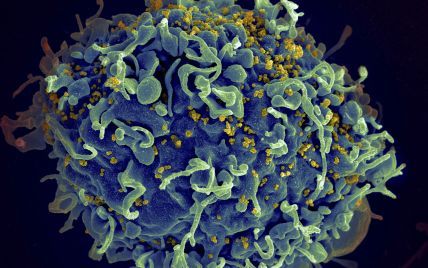 Ученые использовали ВИЧ, чтобы исцелить детей от смертельного недуга