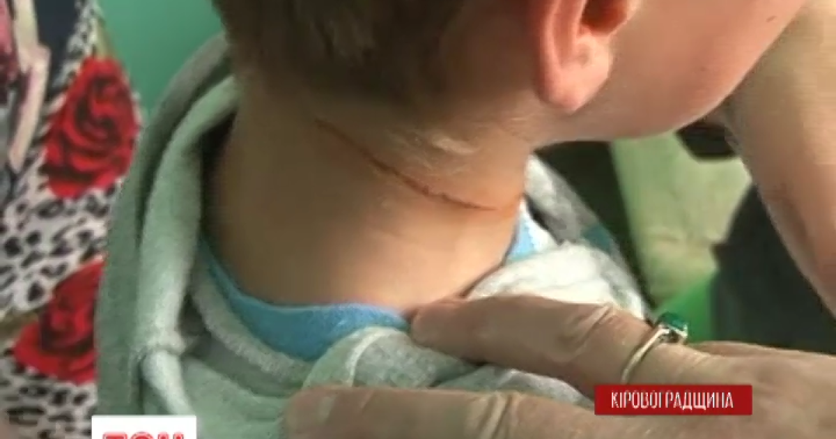 У детей от веревки остались борозды на шее.