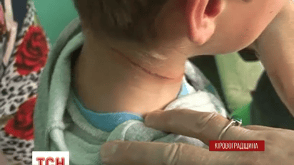 На Кировоградщине 27-летняя женщина пыталась повесить двух своих детей