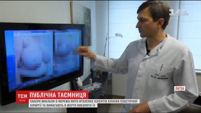 Хакери РФ оприлюднили фото оголених клієнтів литовської клініки пластичної хірургії