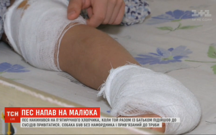 У Києві пес накинувся на п'ятирічного хлопчика: у дитини розірване коліно і п'ята