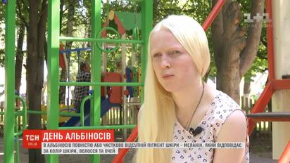 Поцелованные Богом: кто такие альбиносы и как им живется