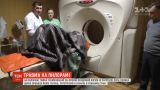 На Буковине вследствие несчастного случая на пилораме тяжело травмирован работник