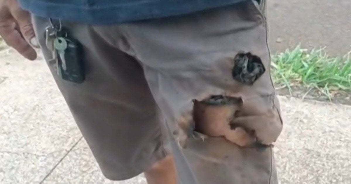 Телефон вибухнув у кармані