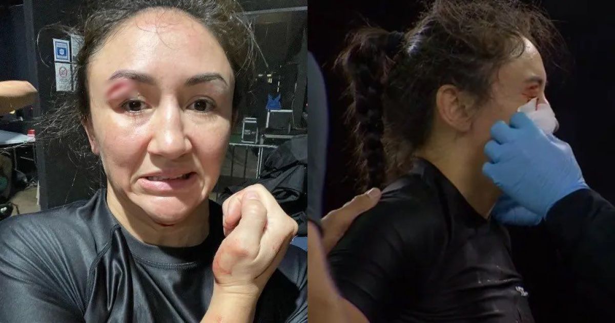 Прикра поразка: ескчемпіонка UFC травмувала себе та програла бій (відео)
