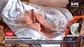 Новости Украины: в Днепре спасают 2-летнего малыша, которого отчим ранил ножом