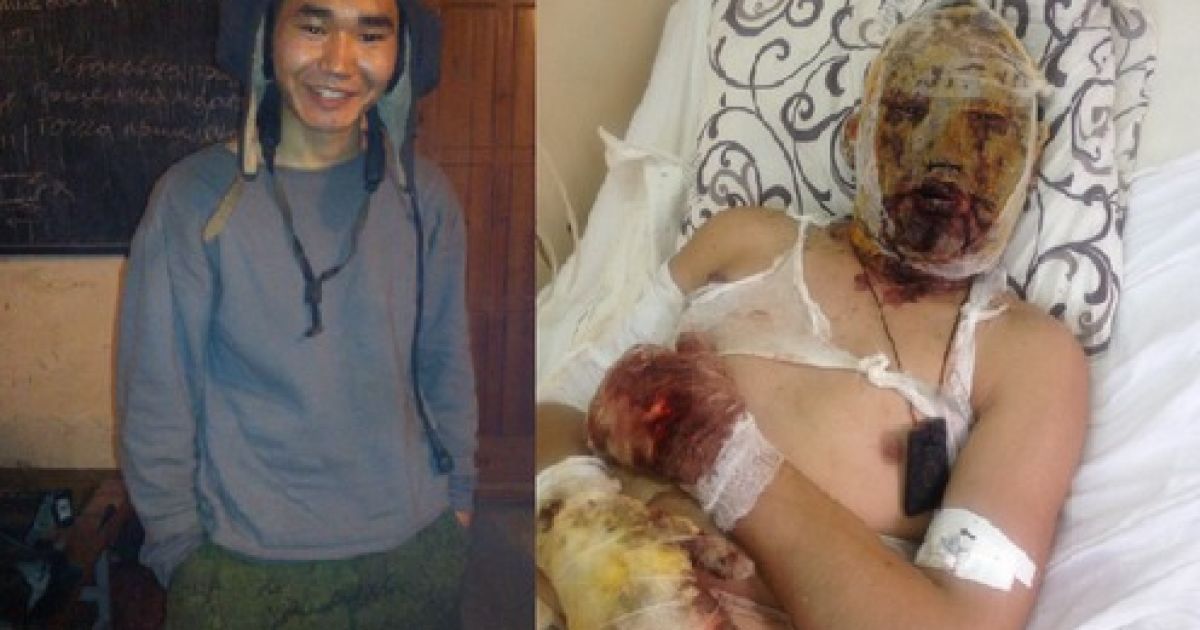 Бурятська газета вирізала матеріал про обгорілого на Донбасі строковика РФ