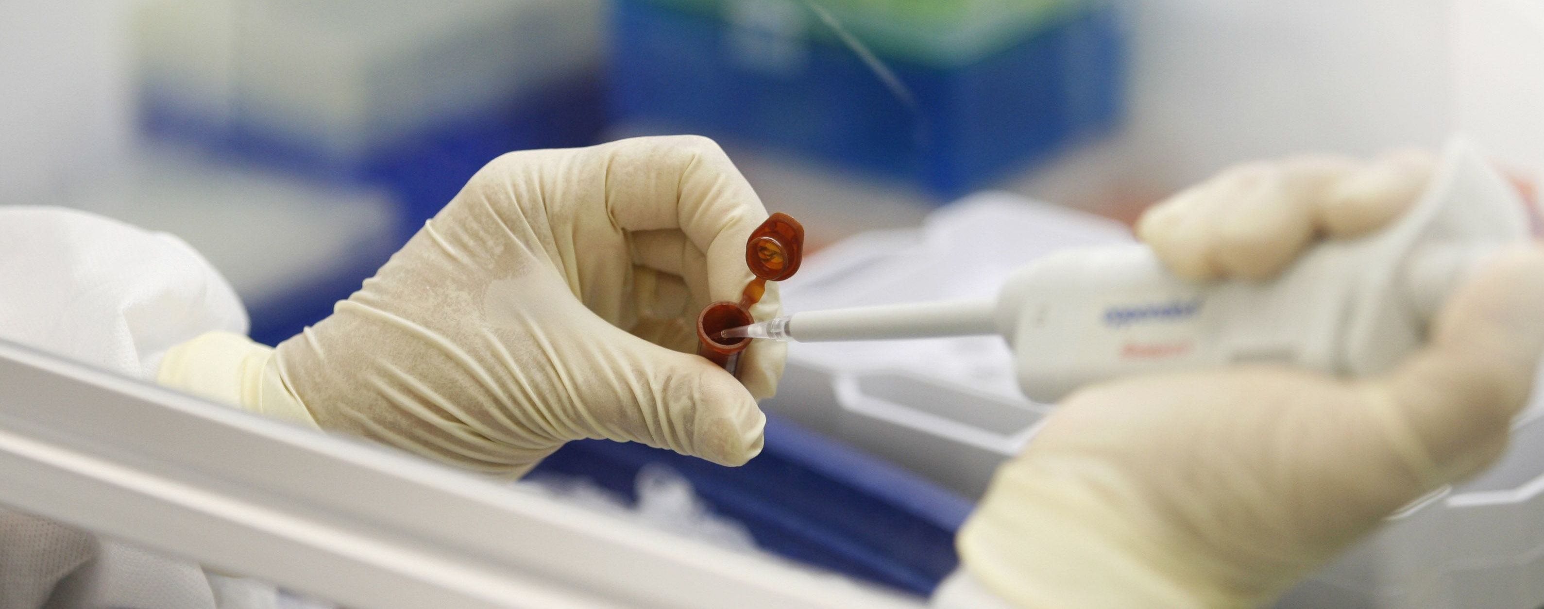 Спотворення ПЛР-тестів на коронавірус у Дніпрі: МОЗ розробляє план повторних перевірок