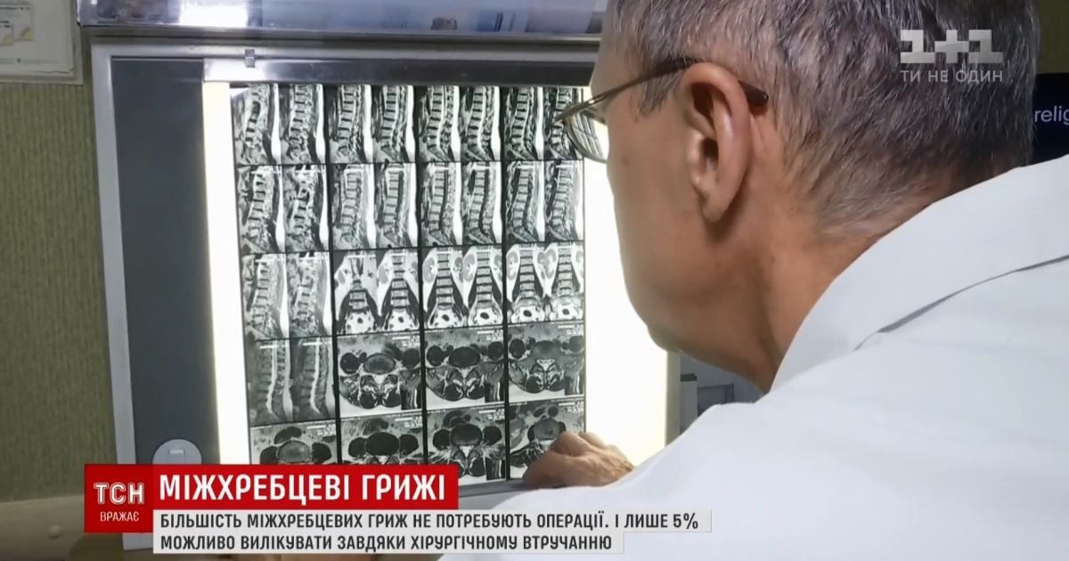 Йога і розумний лікар: науковці розповіли, як позбутися гриж хребта без операцій