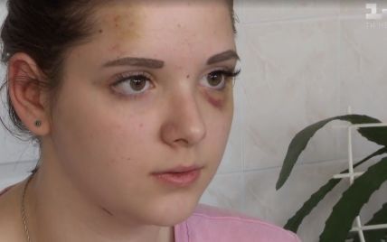 Телефон и межрайонные войны: избитая толпой школьница рассказала о подростковой агрессии в Чернигове