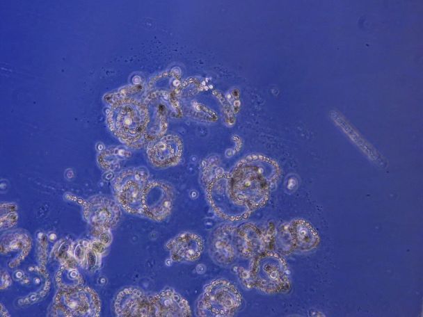 Небезпечні бактерії у воді в Одеській затоці. Фото: Galyna Terenko.