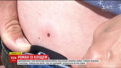Ежегодно 1500 украинцев подхватывают от клещей болезнь Лайма