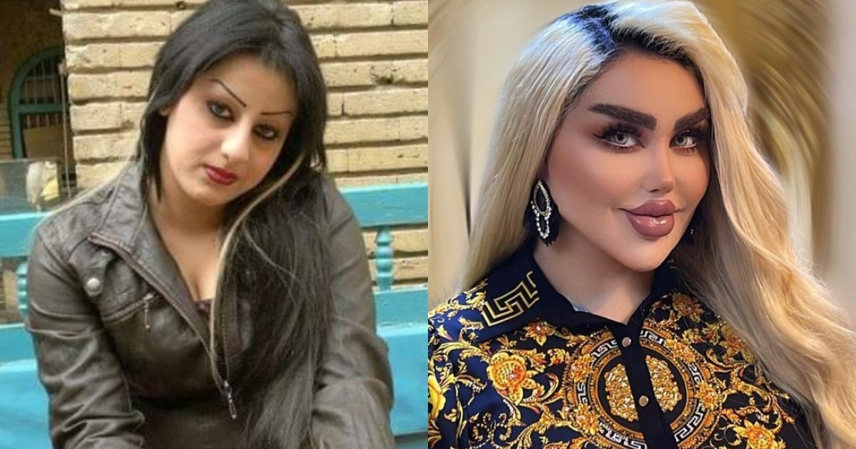Женщина сделала 43 косметические процедуры, чтобы быть похожей на Барби: фото до и после пластики