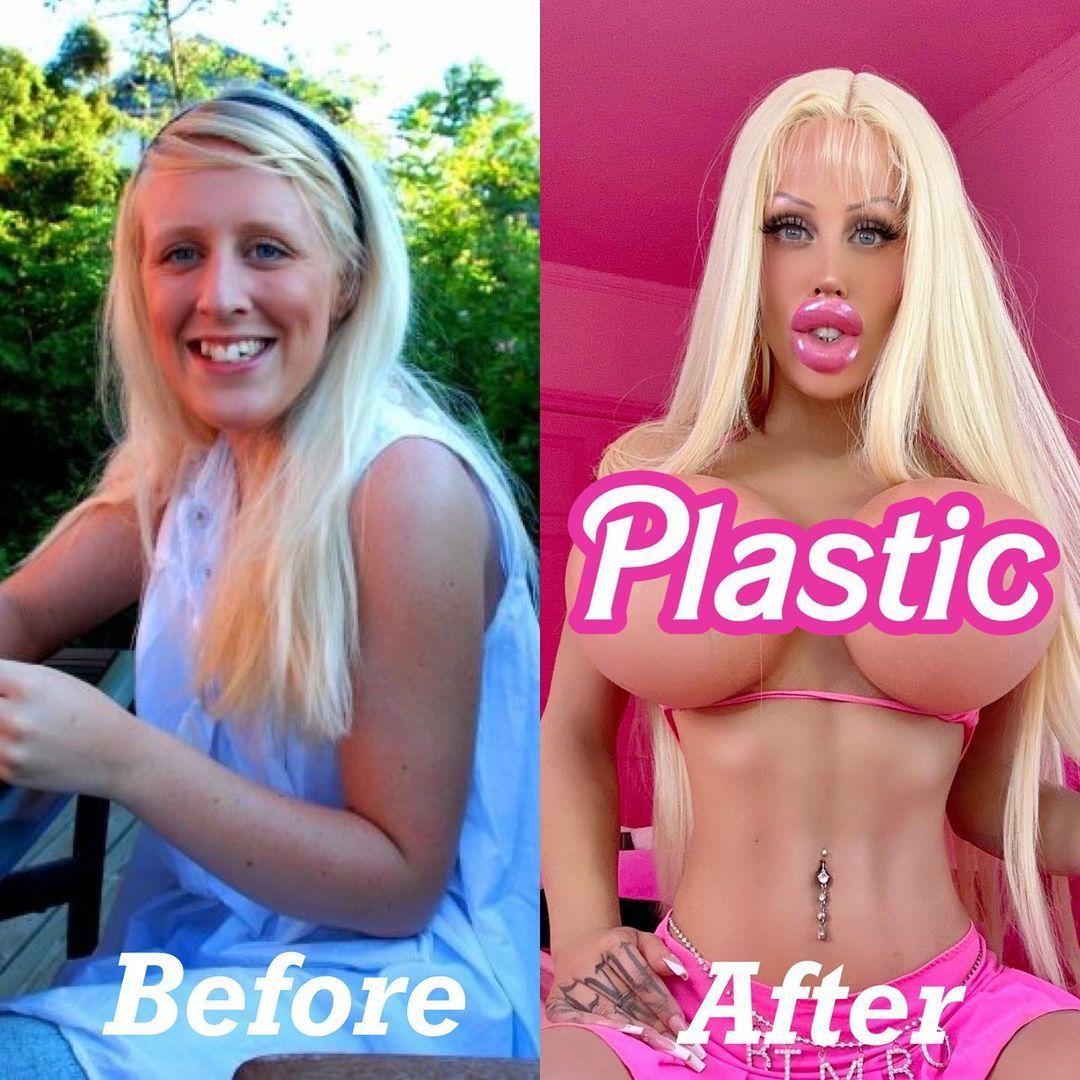 Алисия Амира до и после пластики / Фото: instagram.com/aliciaxamira / © 