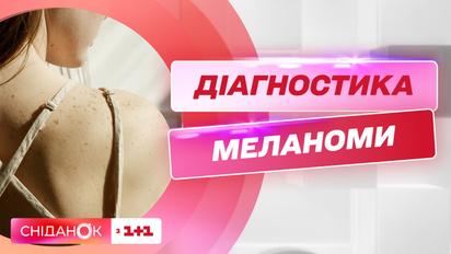 Місяць обізнаності про меланому: що може стати сигналом для відвідування спеціалістів