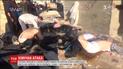 Стали известны результаты вскрытия погибших в Сирии