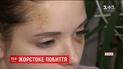 Девушка, которую накануне избила группа подростков, рассказала о пережитом