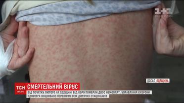 Всі дитячі стаціонари Одещини перевірять на наявність кору