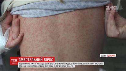 Всі дитячі стаціонари Одещини перевірять на наявність кору