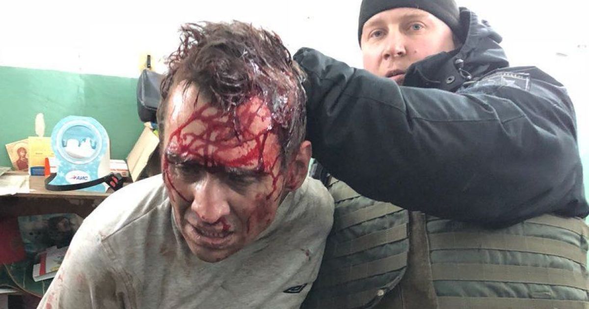 Нападающий локализован.
